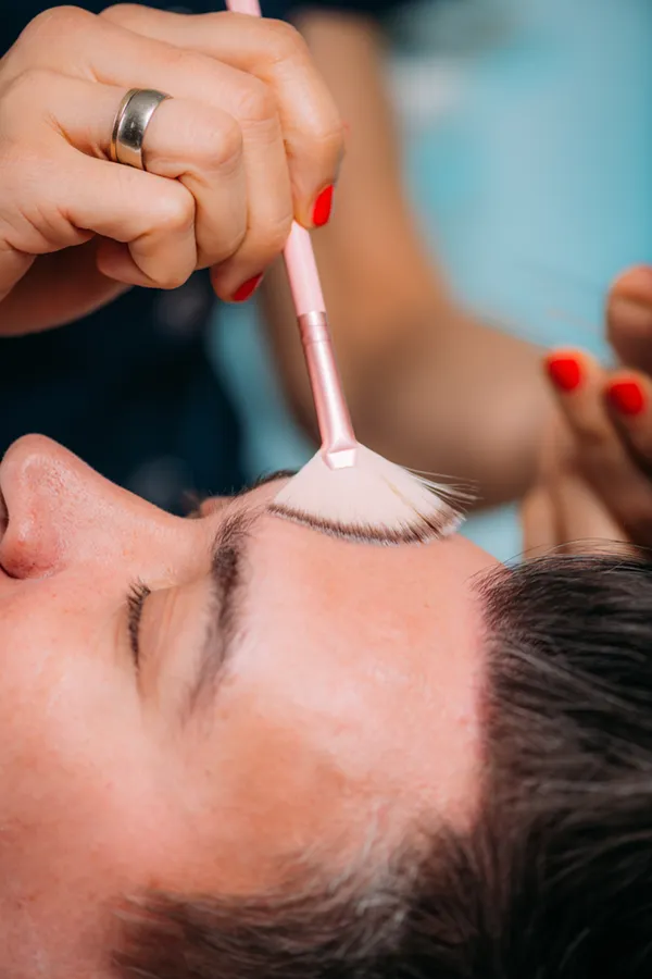 Chemical-Peel-Treament Close-up of a man receiving a chemical peel treatment on his forehead from professional who work with Brandi Terra, NP at Oak & Stone Wellness on East San Diego.