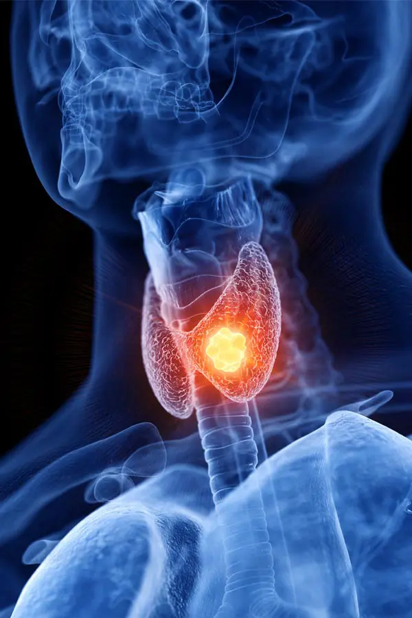 Thyroid-Imbalance-Treatment A 3D illustration of an x-ray of a human neck, highlighting the thyroid. Get help with thyroid imbalance from Brandi Terra, NP at Oak & Stone Wellness in East San Diego.